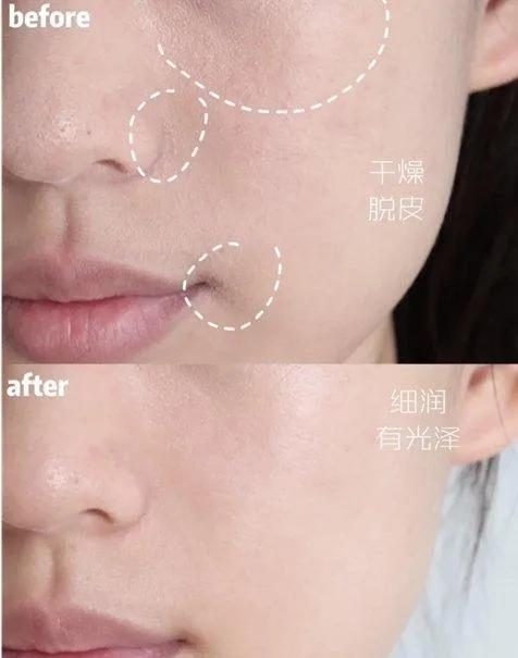 韩国ahc神仙水乳套装效果如何,ahc神仙水乳怎么用