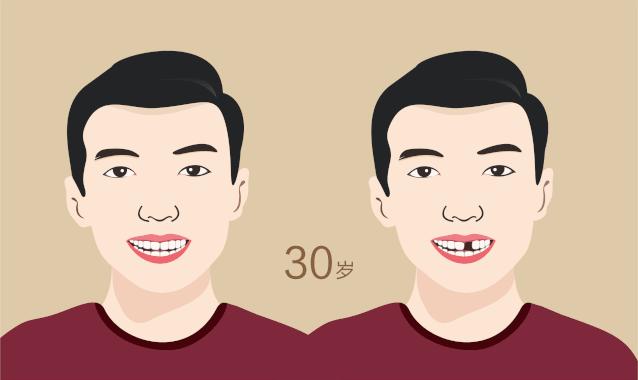 牙齿掉了对其他的牙齿有影响吗,牙齿掉了三个月没有出牙