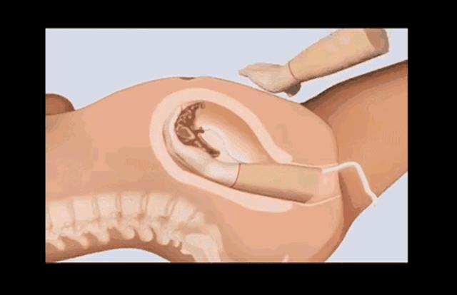 女人生宝宝的科普故事,科普关于女人生孩子