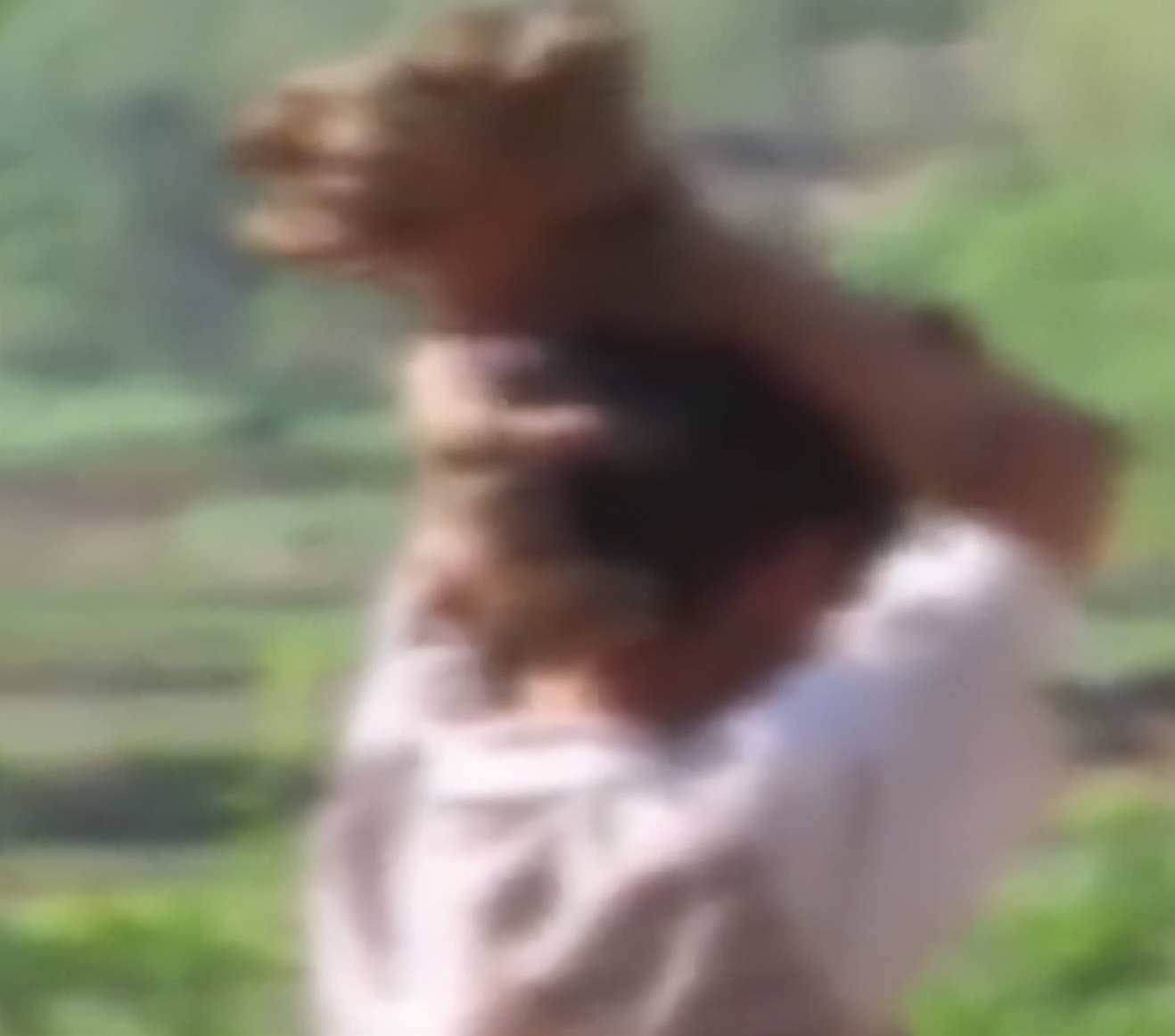 男子得了怪病身上长了树枝,男子患怪病手脚长得像树枝