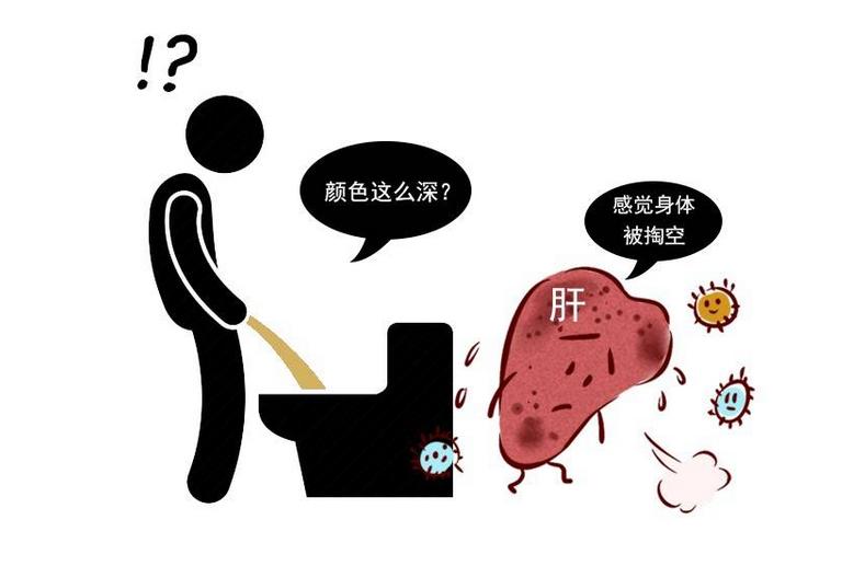 女性尿液很黄白带多怎么回事,女性尿液黄有白色漂浮物