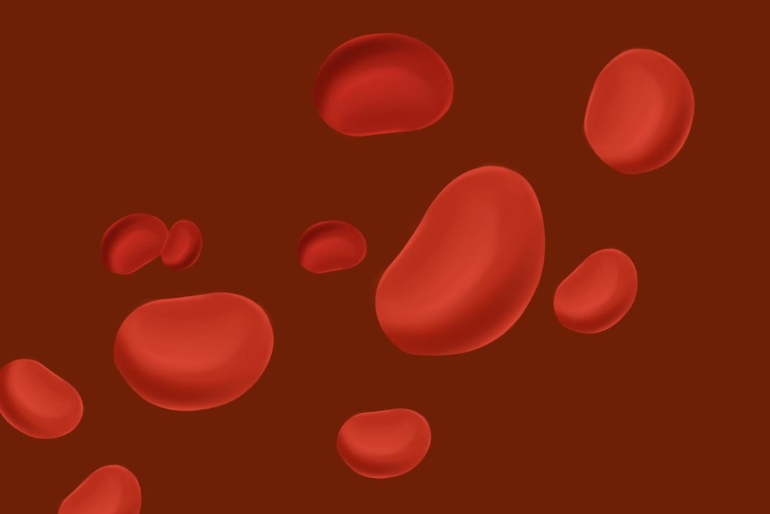 贫血要不要紧,贫血但是什么元素都不缺