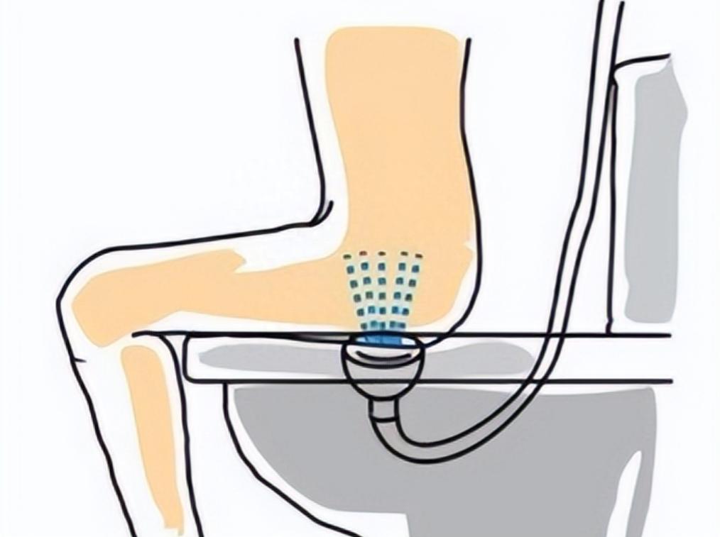 便秘用温水灌肠有害处吗,大人便秘自己灌肠冲洗