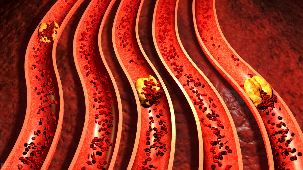 百病生于气万病从肝治,祛湿化痰越鞠丸