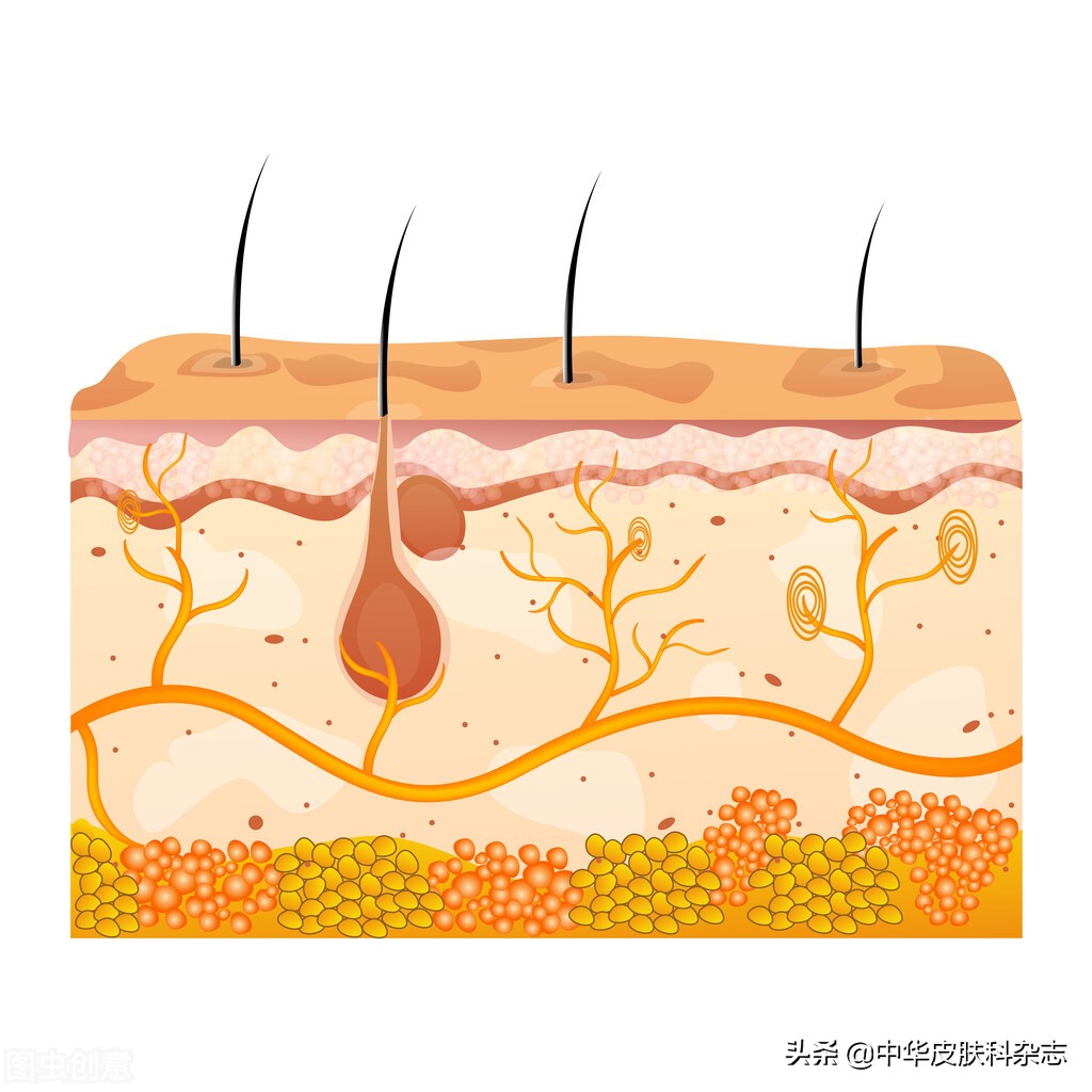 皮下脂肪过多会导致的疾病,皮下脂肪组织都有什么