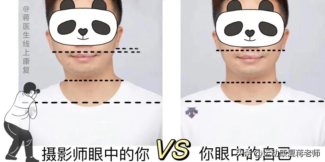 歪头斜脖子矫正方法,歪头歪脖怎么矫正