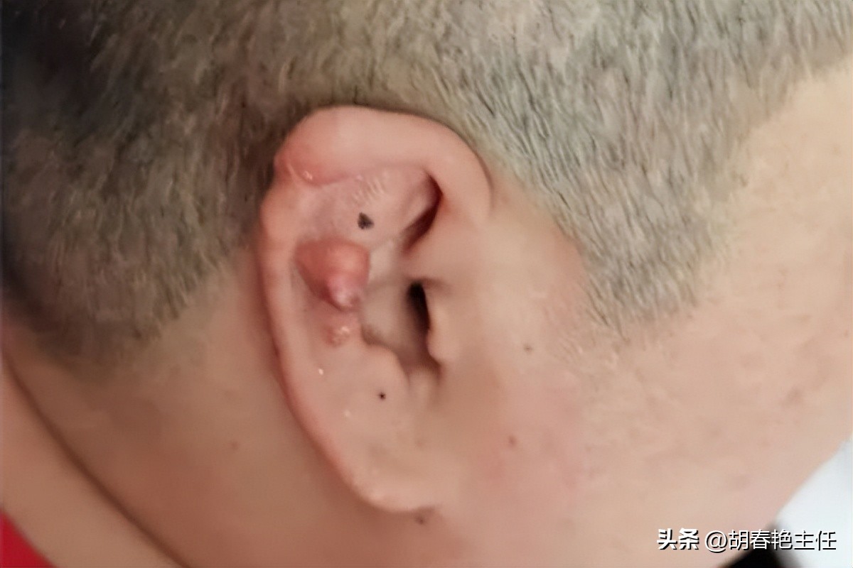 尿酸高会有什么症状和危害,尿酸高的表现症状及调理方法