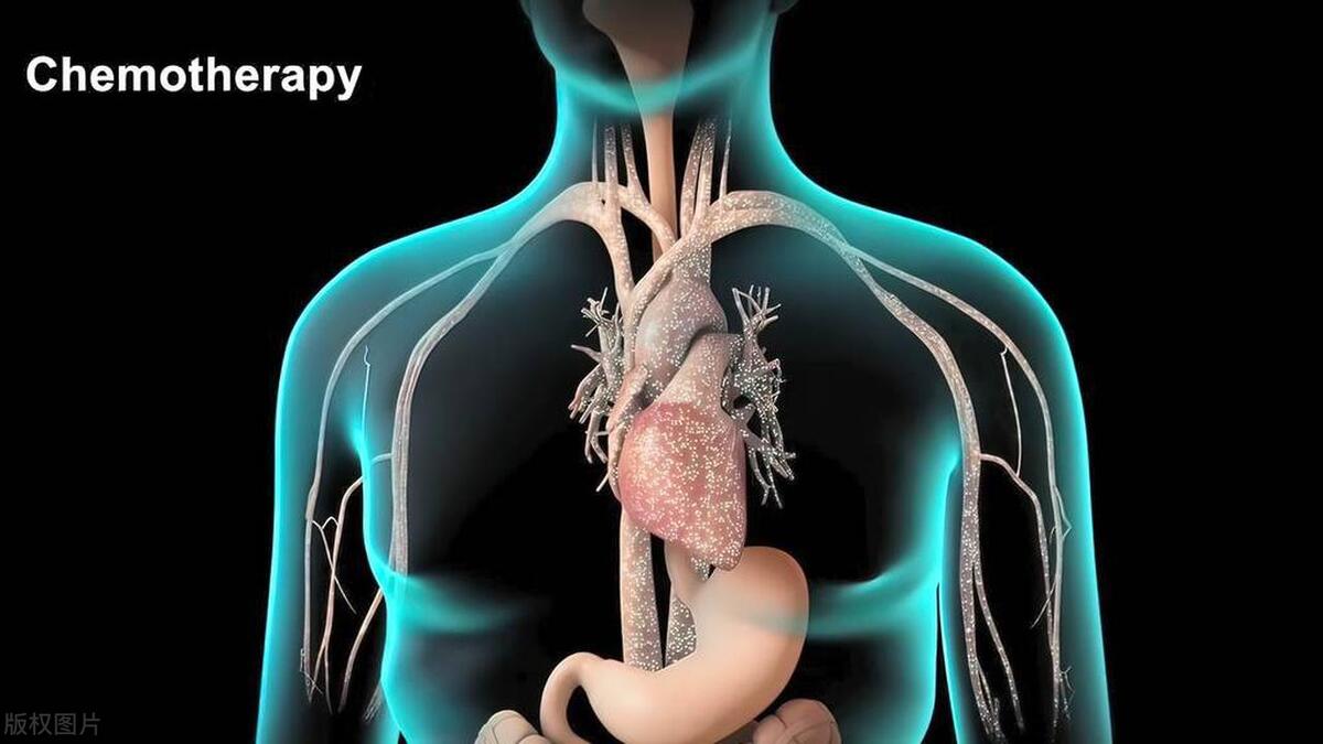什么是化疗揭露化疗真面目,对于化疗放疗的认识