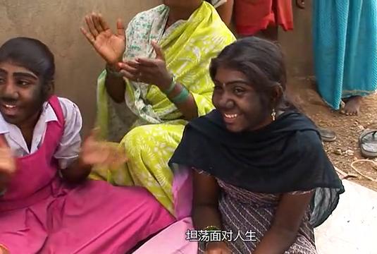 故事:非洲17岁女孩长满络腮胡,毛发从鼻孔长到脖子,身体有何异常