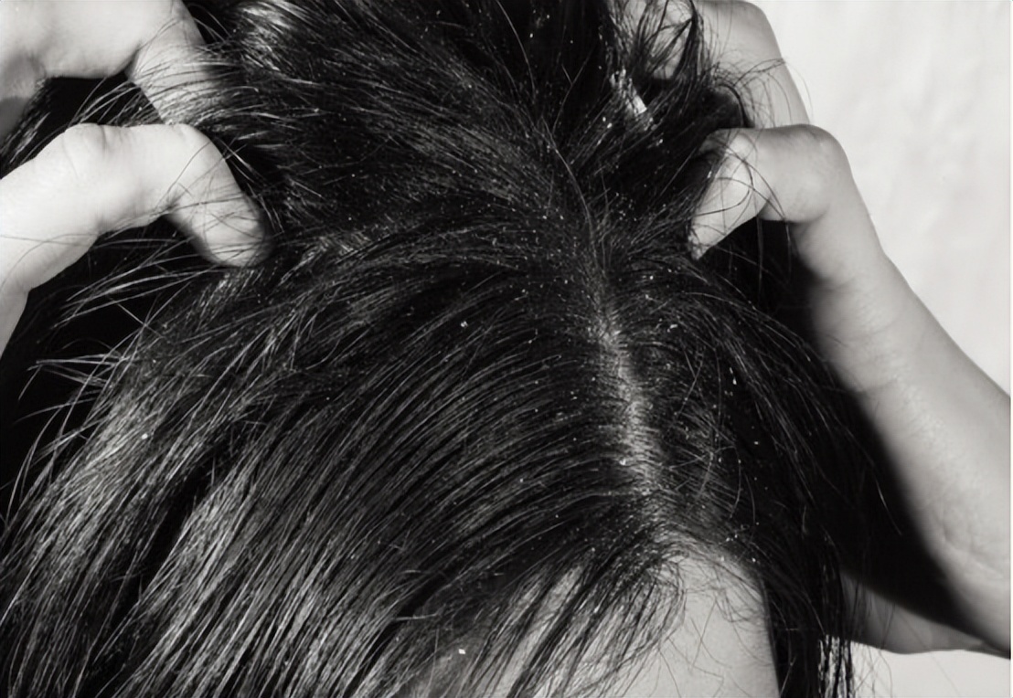 头皮上摸到一个硬疙瘩,头皮有小疙瘩摸着疼怎么回事