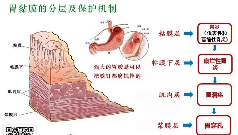 慢性胃炎的中医诊断及诊疗,慢性胃炎西医诊断流程