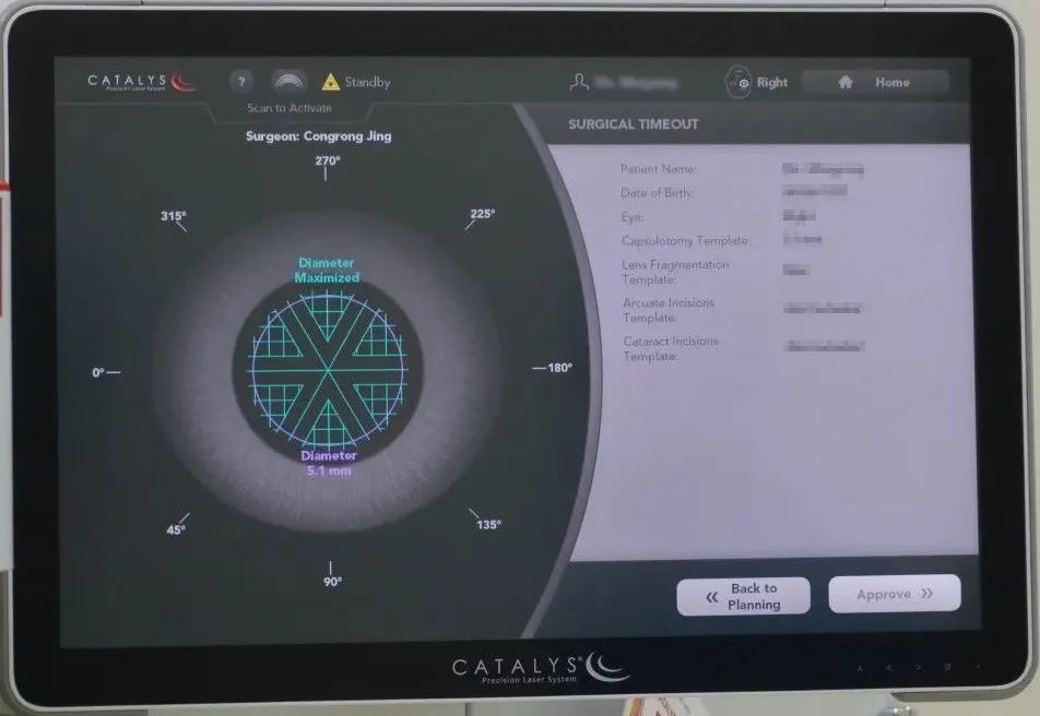 飞秒激光白内障手术有什么问题,爱尔康飞秒激光白内障手术