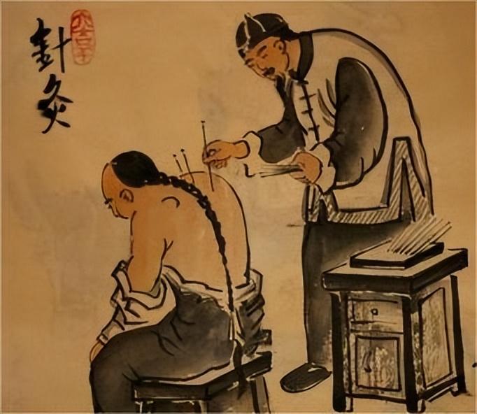 日本针灸铜人,日本古代铜人针灸