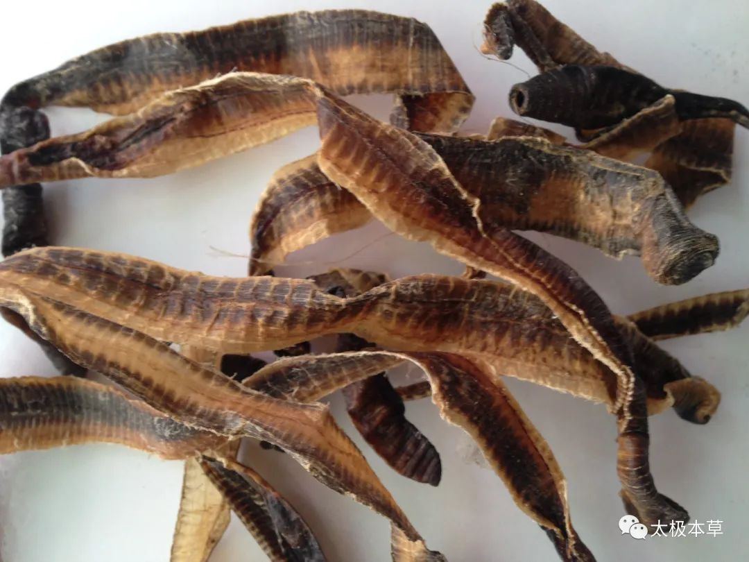 李卓杰治下肢静脉曲张验方,精索静脉曲张中药验方