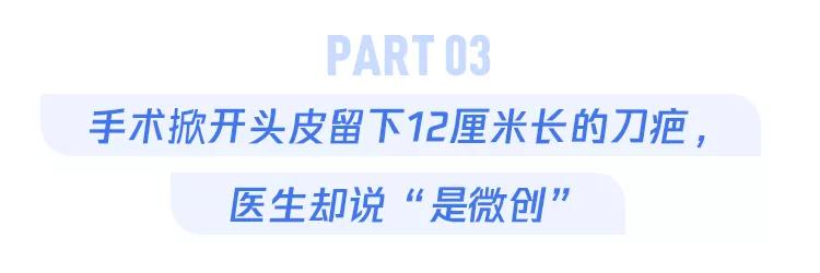 开颅手术后被掀开的头皮多久恢复,开颅手术掀开头皮头皮怎么恢复的