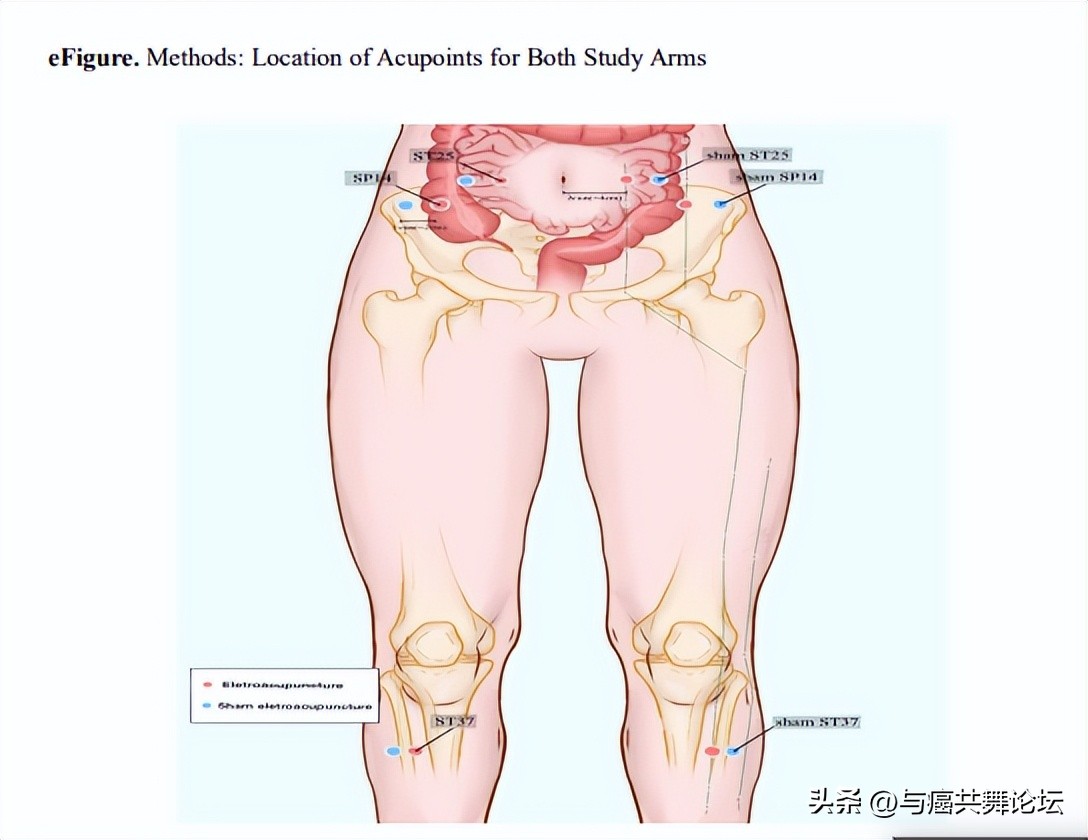 镇痛药便秘,用止痛药便秘有什么办法
