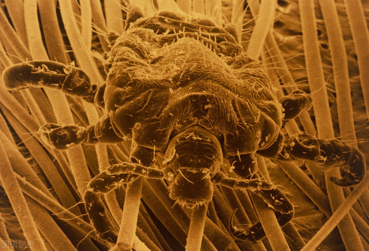 阴虱是女人引起还是男人引起,女性阴虱是什么原因引起的