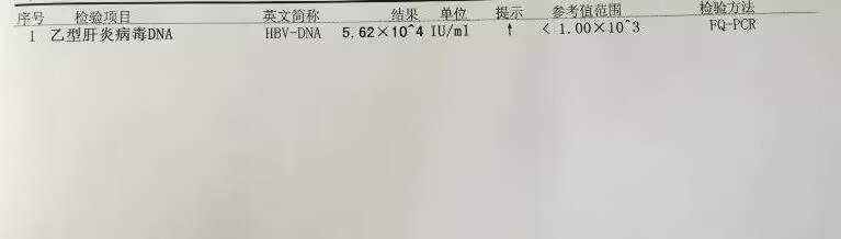 乙肝病毒c抗体数值比较高一点,乙肝病毒滴度高低说明了什么