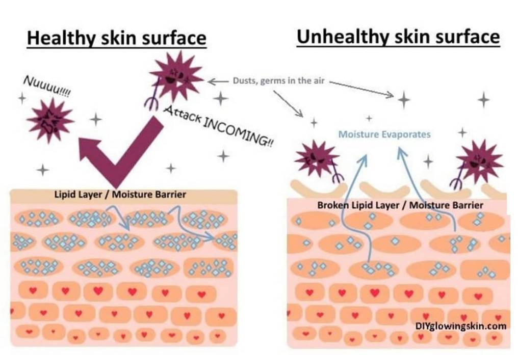 用了护肤品皮肤刺痛是缺水吗,护肤刺痛缺水怎么回事