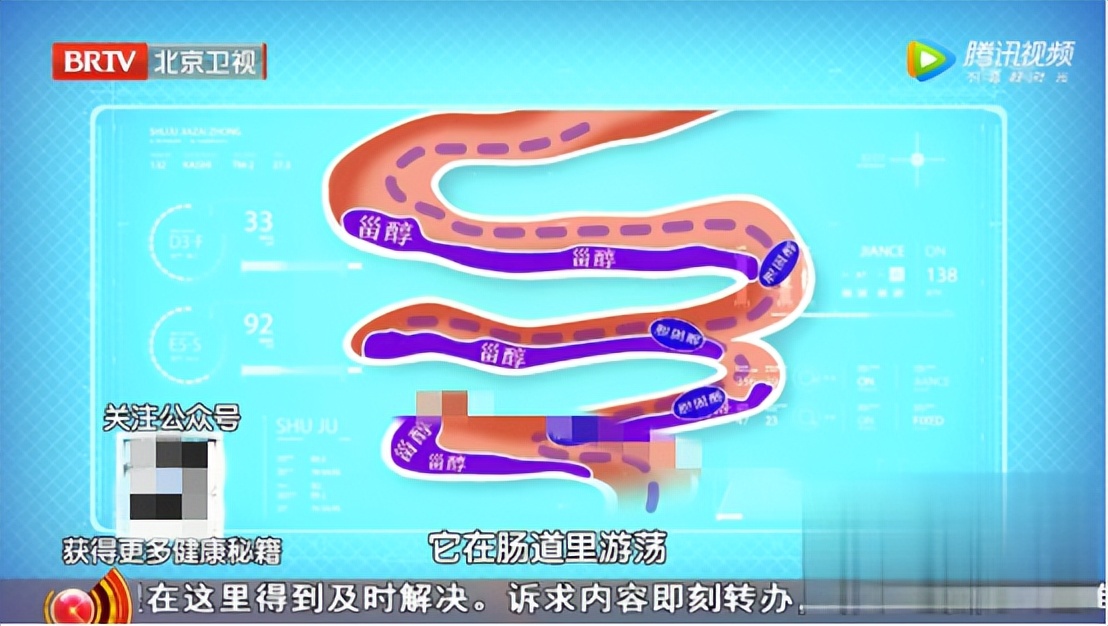 瘦人如何降胆固醇,吃什么最容易增胆固醇和血脂