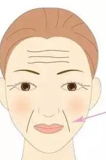 奖门人提醒：别叫“纹”题成问题，皮肤科医生教您抵抗岁月痕迹
