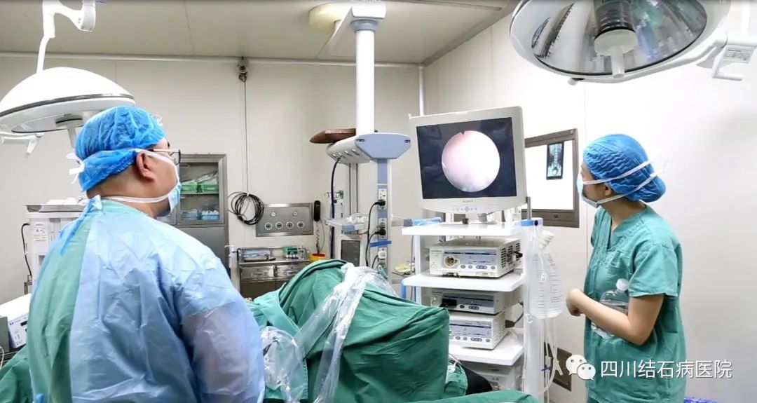 膀胱结石最大的有多大,罕见膀胱结石