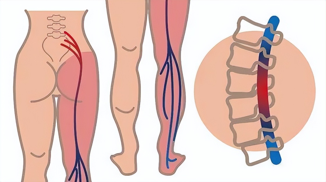 神经受损吃b1还是b12,甲钴胺和维生素b1修复神经