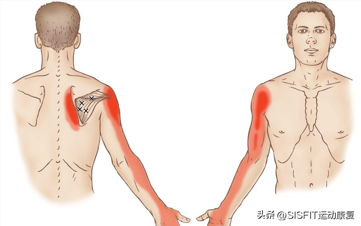 冈下肌，拦顺风车要使用的肌肉