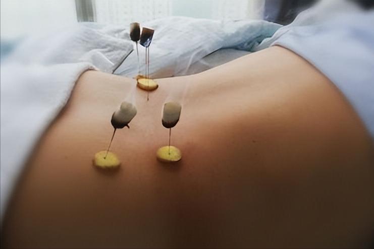 糖尿病肾病气阴两虚型食疗药膳,糖尿病肾病引起腹泻用什么中成药