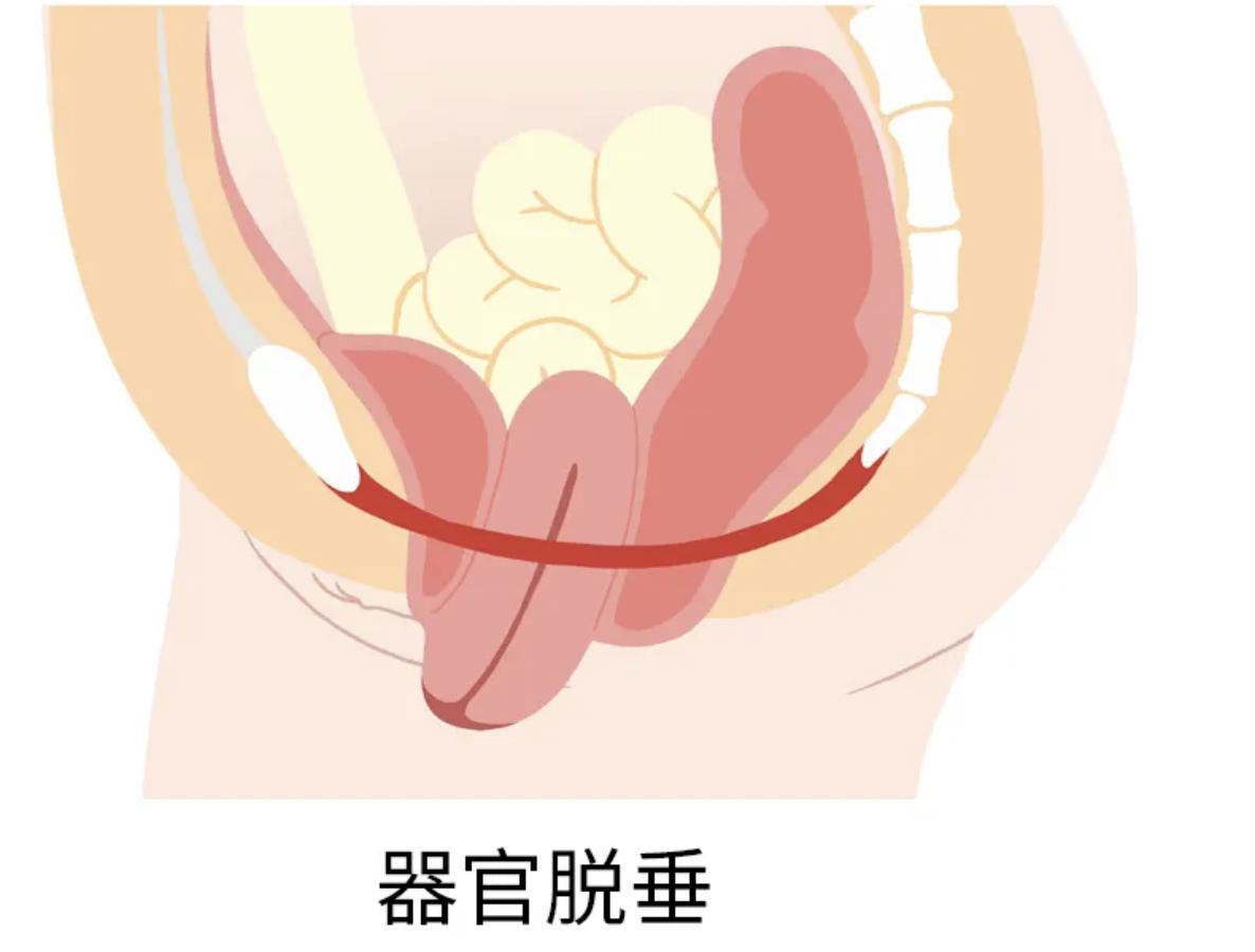 痛苦的疾病治疗,几种不需要治疗的妇科疾病