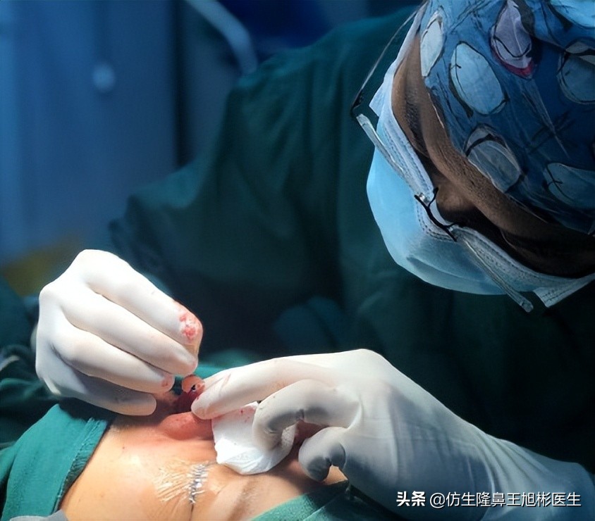 做一次鼻头缩小要多少钱好,可以只做鼻头缩鼻翼吗