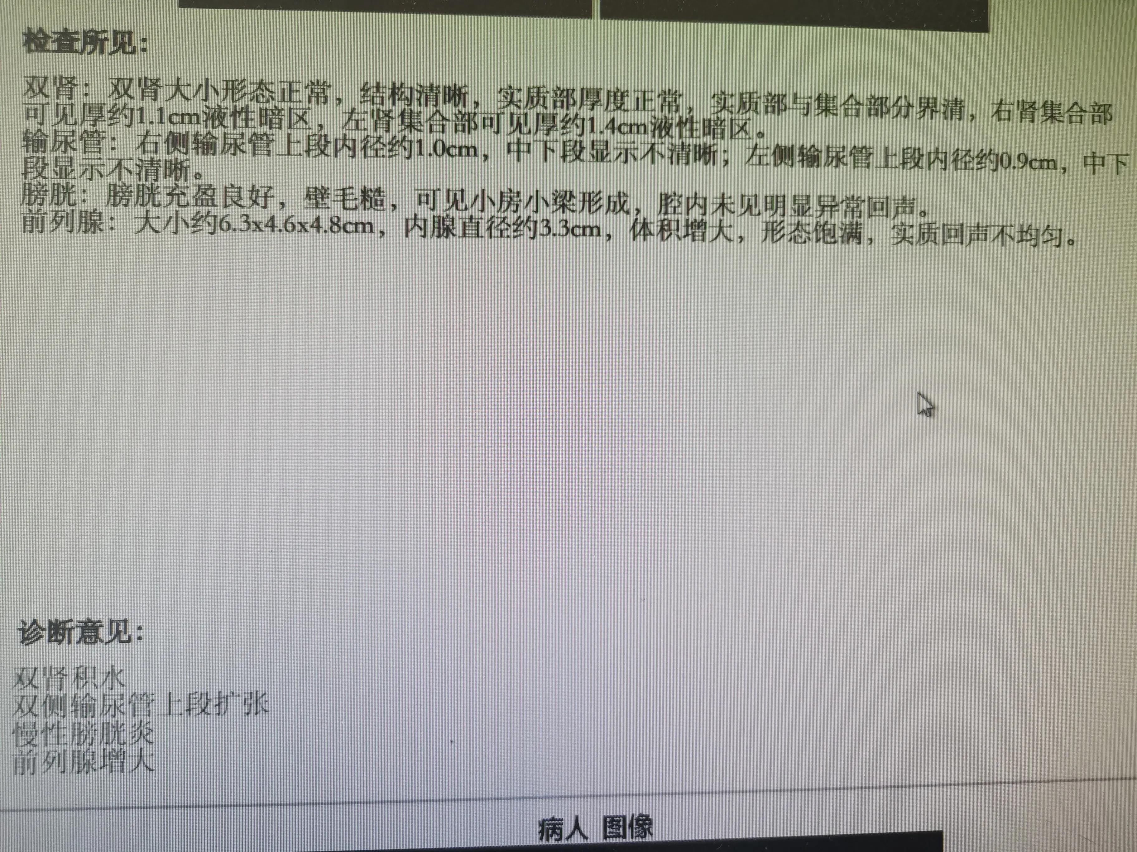 男性前列腺的常见问题,男性应警惕前列腺炎两个误区