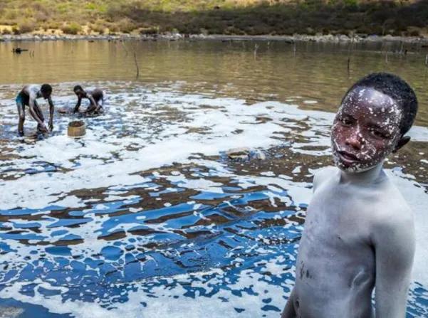 日薪60元的非洲采盐人，用命换钱，几年时间全身溃烂、耳聋失明