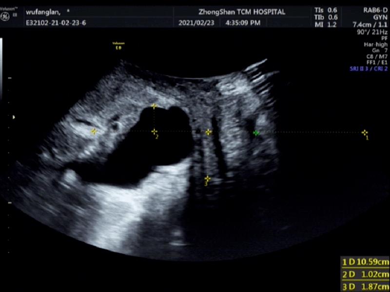 怎么办？下面“长”出了奇怪的东西