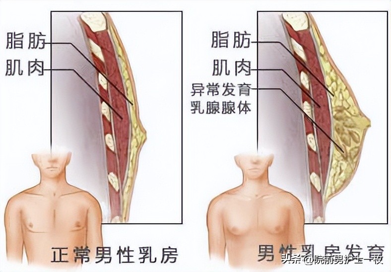 世界男性健康日健康误区,男性健康日科普先行