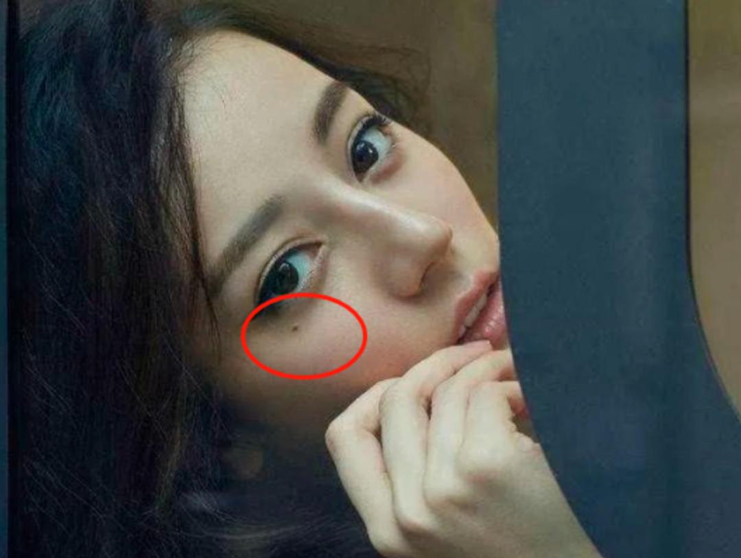 女生脸上长痣怎么快速处理,女生脸上长痣影响颜值吗