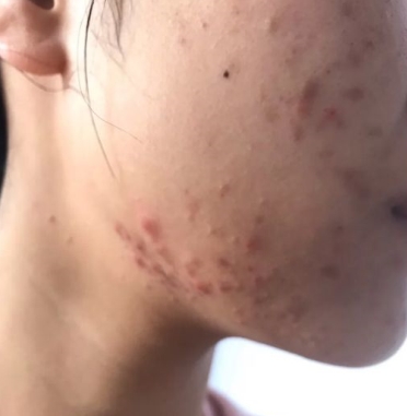 孕妇专用护肤品有哪些比较好的,孕期护肤品推荐孕妇用哪款