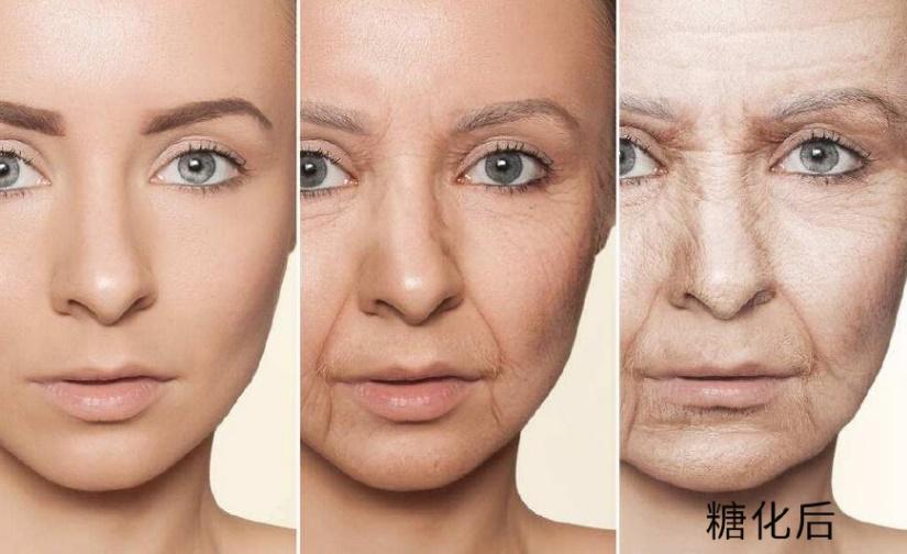 皮肤糖化怎么改善,皮肤糖化怎么治
