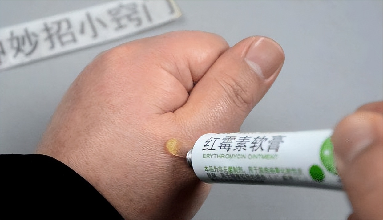 红霉素眼膏能治老年斑,红霉素软膏为什么不能消除老年斑