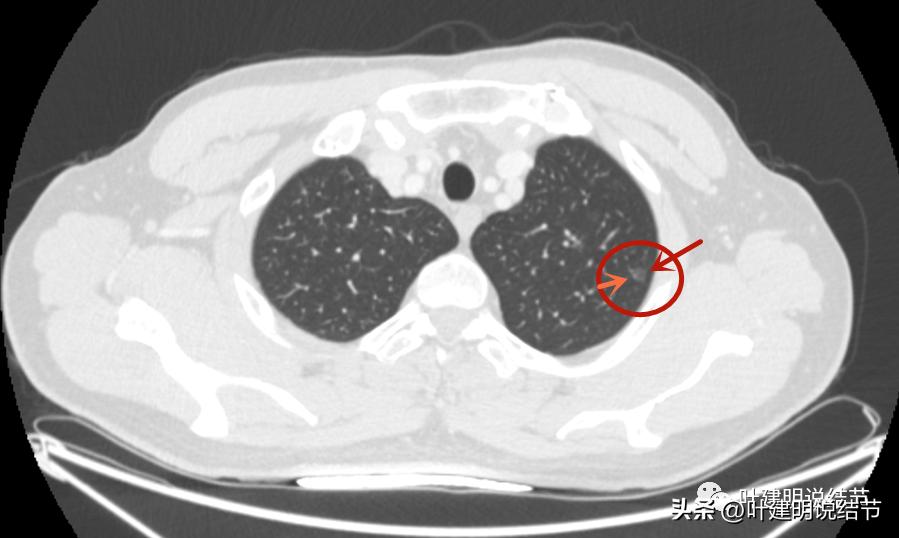 医生为了预防医患矛盾过度诊疗,医院过度医疗手术