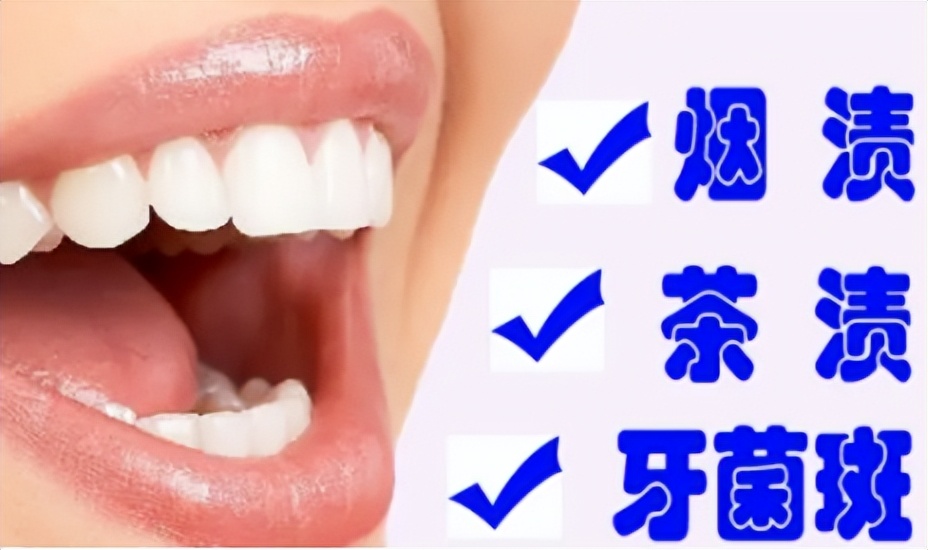 2023扉乐电动牙刷测评,usmile和飞利浦电动牙刷吐槽测评