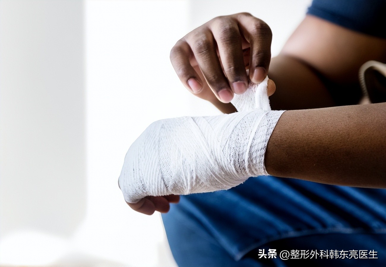 受伤后如何护理才能避免留疤,额头受伤怎么防止留疤