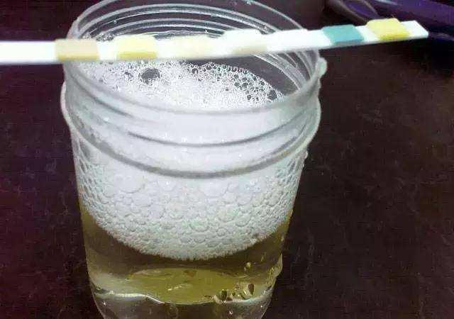 尿酸高上厕所症状,尿酸高上厕所有什么反应