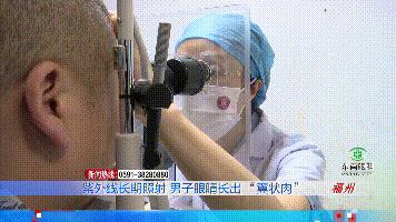 35岁男子视物模糊查出肝癌晚期,眼睛有翼状胬肉属于白内障吗