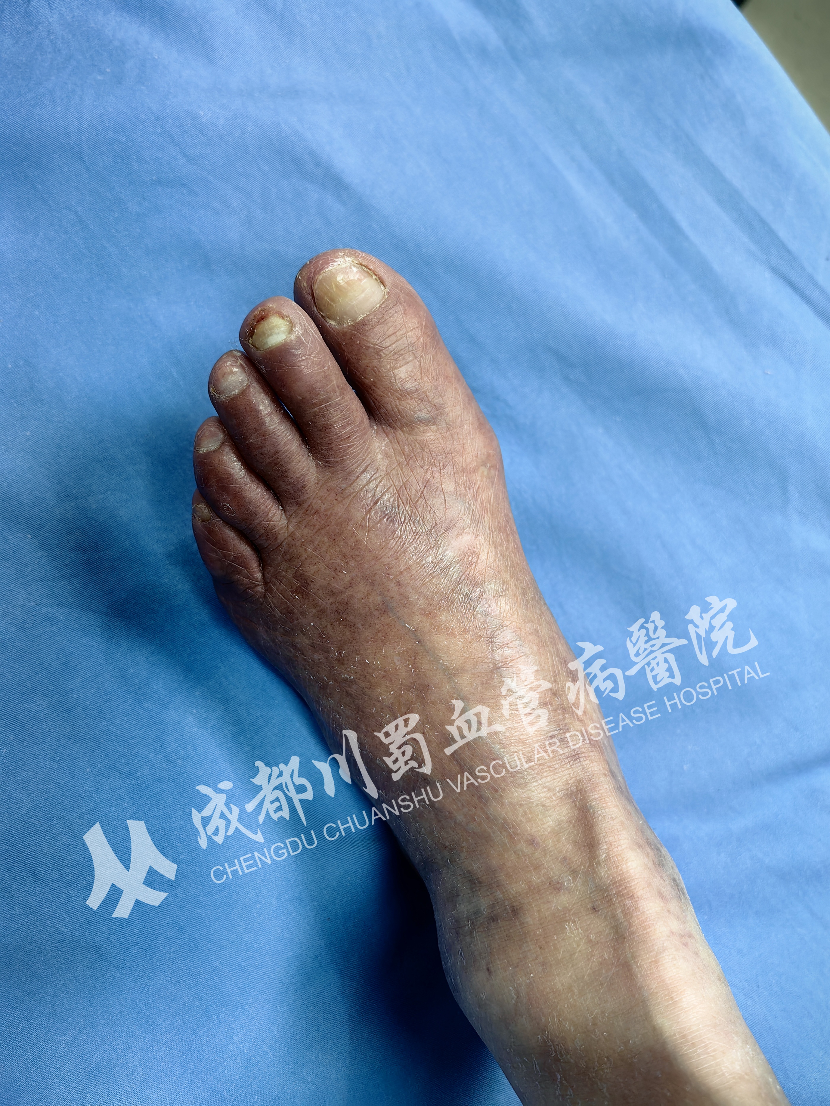 记忆力下降脑子开始懵头晕疲劳,头晕记忆力下降迷糊怎么回事