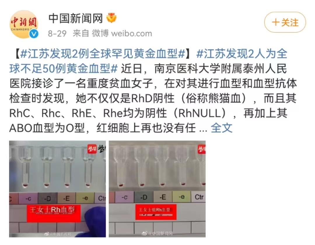 全国特别罕见的血液,全球黄金血液跟熊猫血