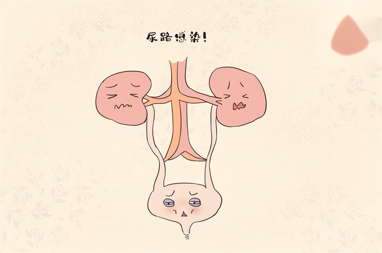 前列腺理疗什么意思,前列腺理疗是什么意思