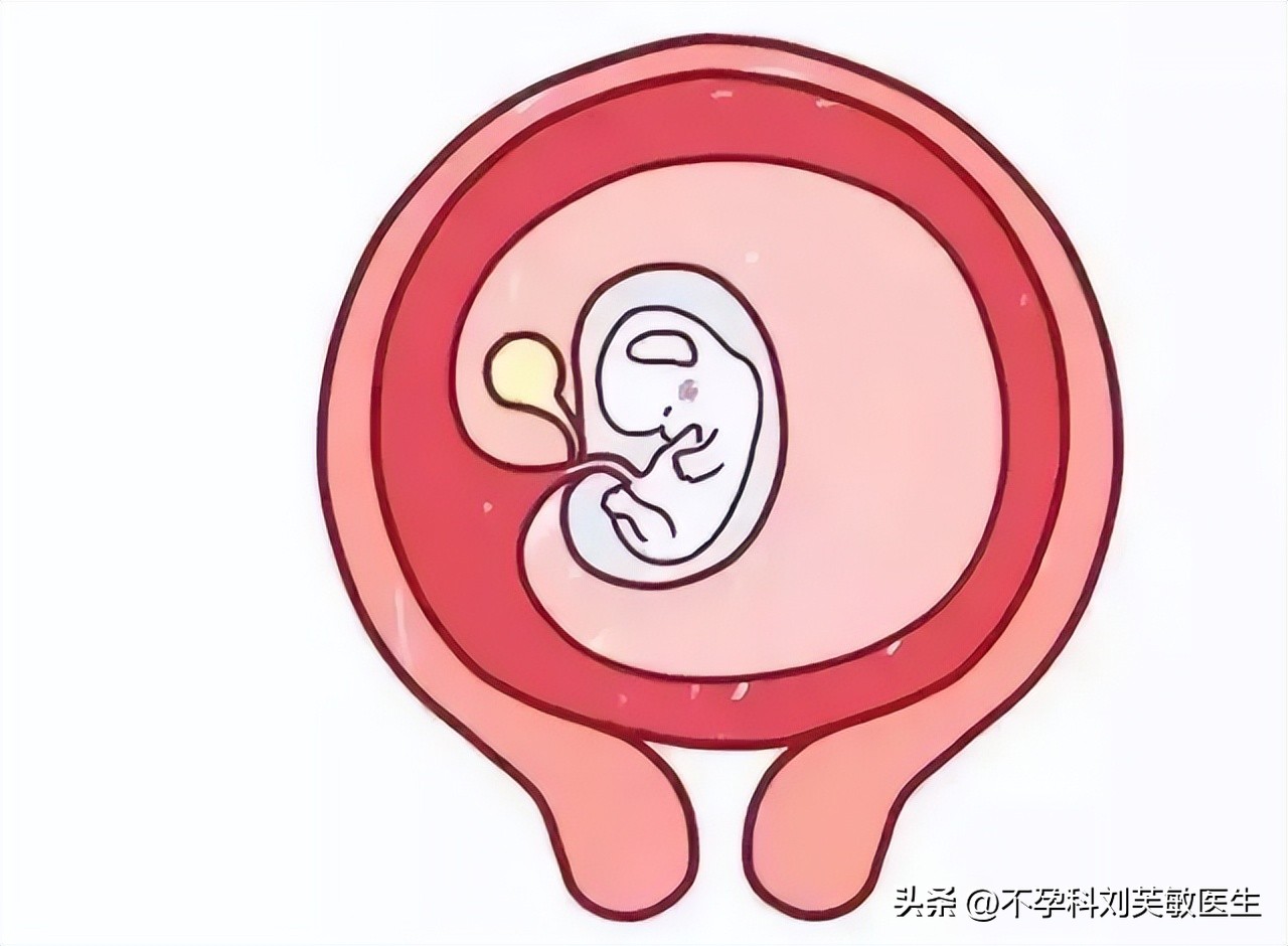 保胎之早孕期超声检查,精准保胎课程视频教程