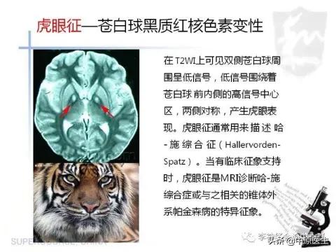 老虎的体质有多强,老虎与人类关系好吗