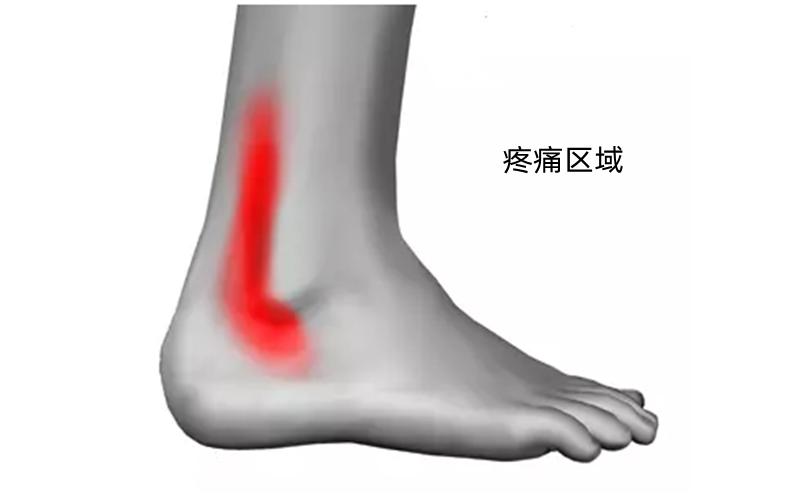 脚踝走路咯咯响怎么回事,走路脚踝发出清脆响声还容易抽筋